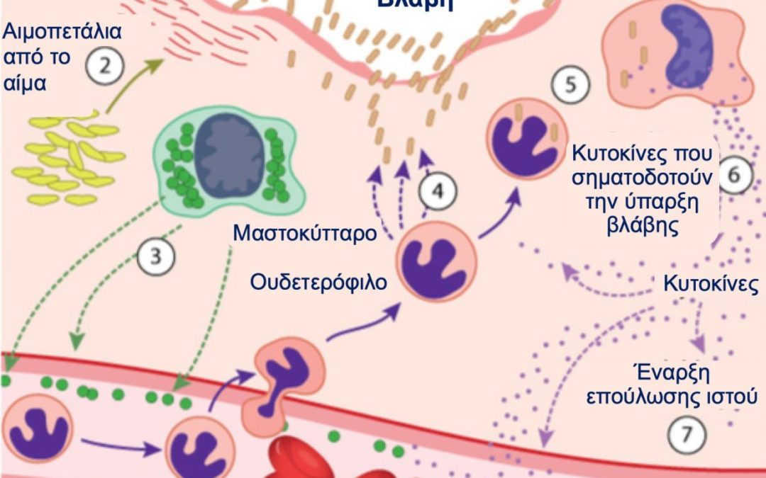 Συστηματικός Ερυθηματώδης Λύκος & Χρόνια Φλεγμονή